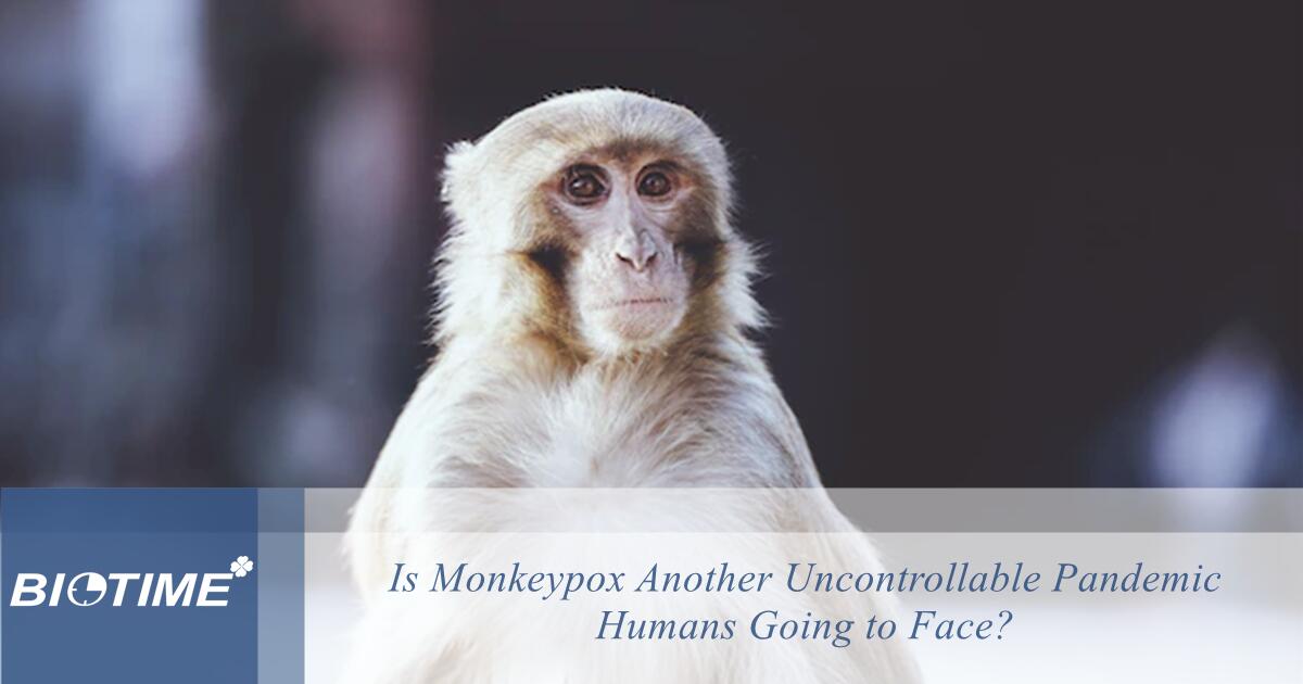 A varíola dos macacos será outra pandemia incontrolável que os humanos enfrentarão?
